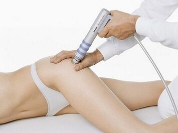 shockwave therapy for hip arthritis