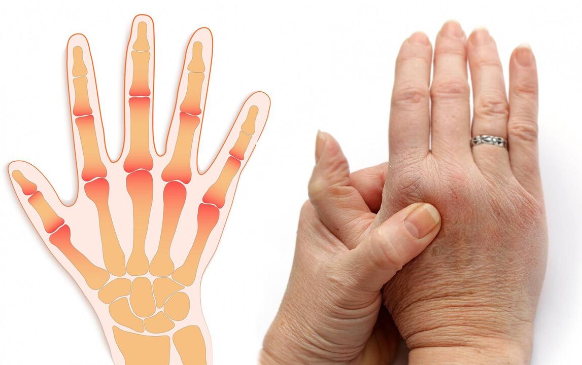 finger diseases