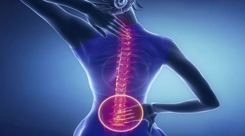 Osteochondrosis of the spine