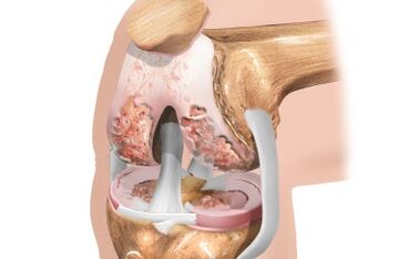 Ligament diagram