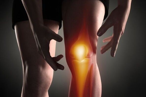 Osteoarthritis of the knee joint