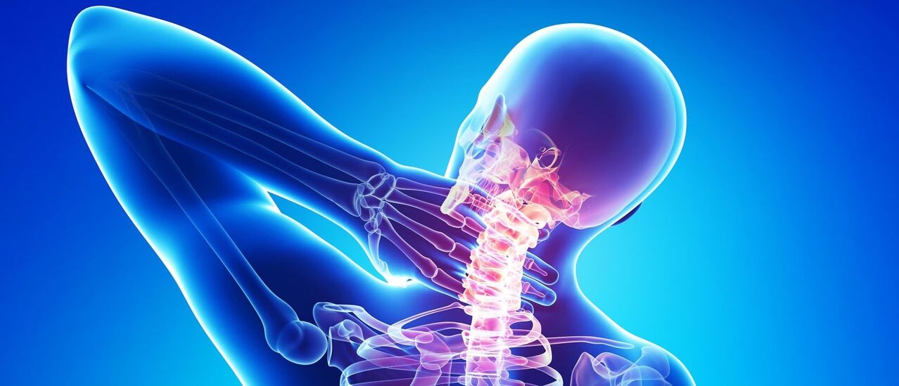 Cervical osteochondosis is a pathological process in the spine area
